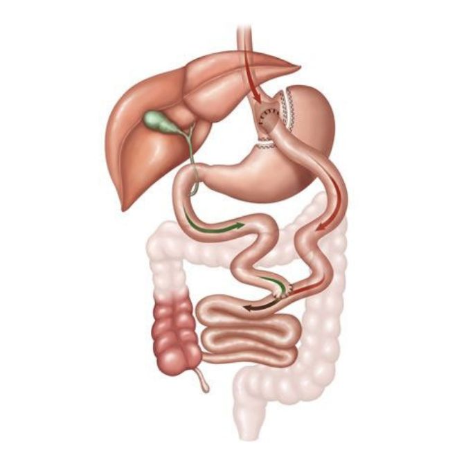 Dr Mauricio Lacerda | Cirurgia Bariátrica